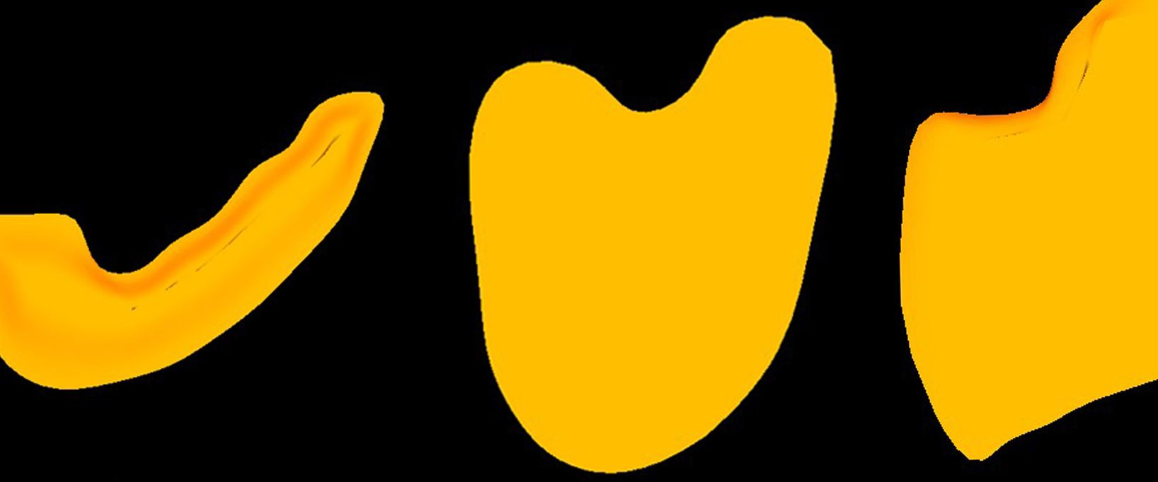 Drei gelbe, unterschiedlich geformte Polsterelemente für orthopädische Einlagen auf schwarzem Hintergrund.